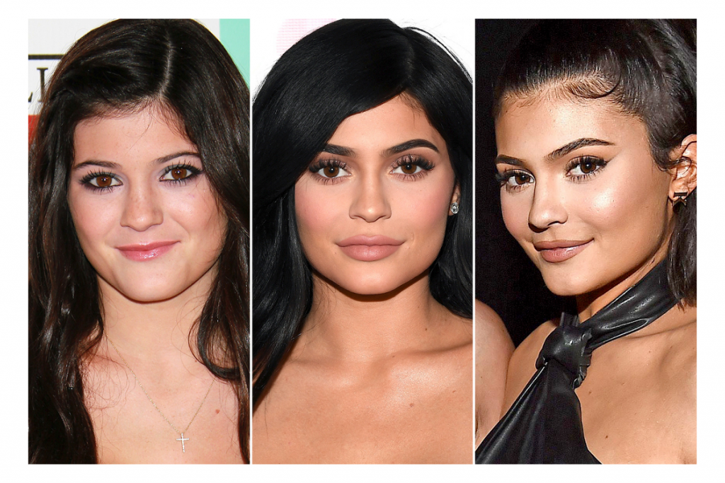 Top Surgeries the Kardashians and Jenners have Performed - Plastic ...