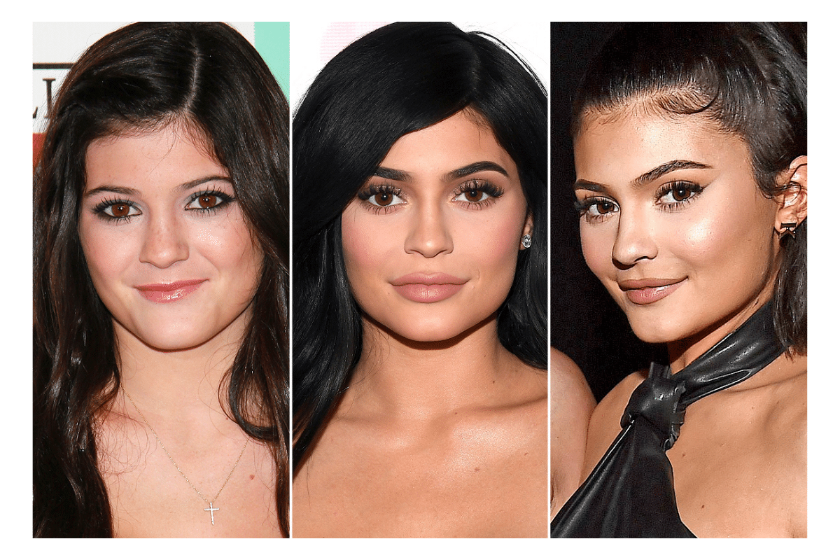 Top Surgeries the Kardashians and Jenners have Performed - Plastic