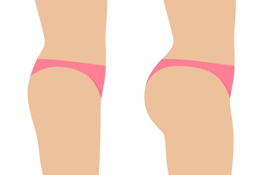 Brazilian Butt Lift Workout Before and after Ogluda