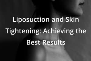 Liposuction and Skin Tightening